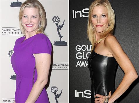 Anna Gunn Weight Loss: Actress Says Weight Gain。